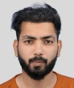 Hair Transplant After Results - Best Hair Transplant Clinic in Delhi